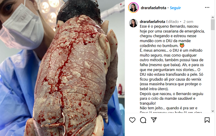 (Foto: Reprodução/@drarafaelafrota)