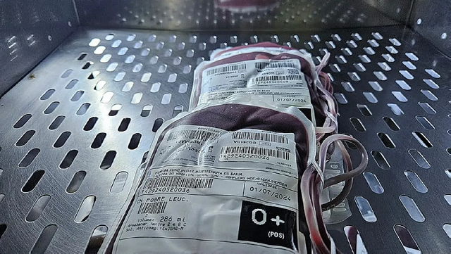 Pesquisadores analisaram dados de 48 estudos genéticos, que incluíram aproximadamente 17.000 pacientes com AVC (Foto: Diogenes Matos Santos/Divulgação)