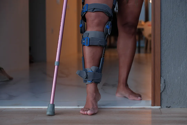 Detalhe do joelho lesionado de mulher que alega avaliação médica equivocada por três vezes consecutivas (Foto: UendelGalter/Ag A Tarde)