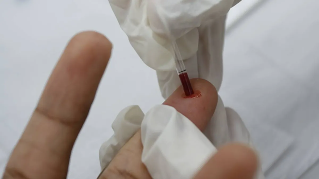 Mais testes rápidos de HIV podem explicar aumento de casos (Foto: Olga Leiria/Ag. A TARDE/29.11.2023)