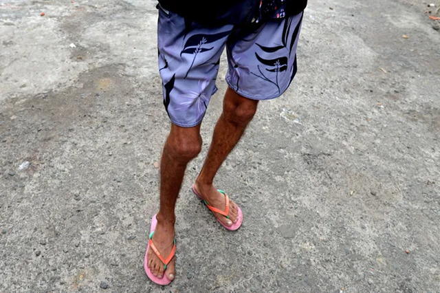 Trabalhador com paralisia diz ter trabalhado sem carteira assinada (Foto: Shirley Stolze/Ag. A TARDE) Trabalhador com paralisia diz ter trabalhado sem carteira assinada (Foto: Shirley Stolze/Ag. A TARDE)