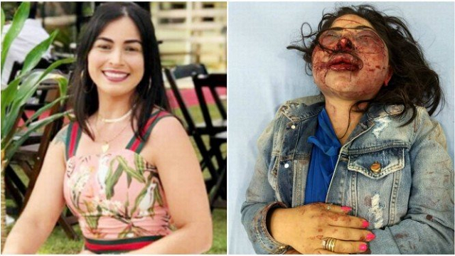 Jane foi encontrada nua e ferida numa estrada (Foto: Arquivo pessoal) Jane foi encontrada nua e ferida numa estrada (Foto: Arquivo pessoal)