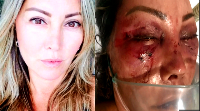 Elaine Perez Caparroz antes e depois das agressões (Foto: Reprodução)