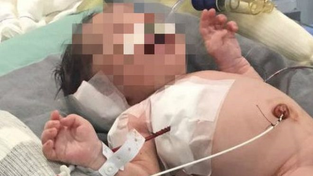 Bebê que foi baleado na cabeça no útero da mãe (Foto: Ilustrativa)