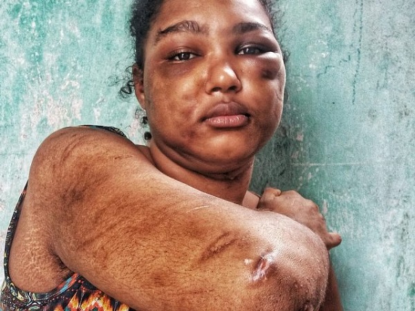 Deisiane foi resgatada pelo pai, que a achou amarrada na cama (Foto: Evandro Veiga | CORREIO)