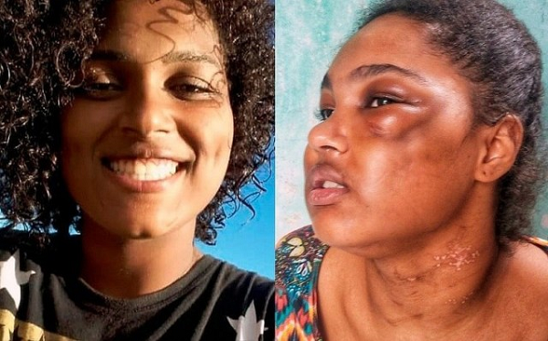 000000000000000000000torturada-camasariense