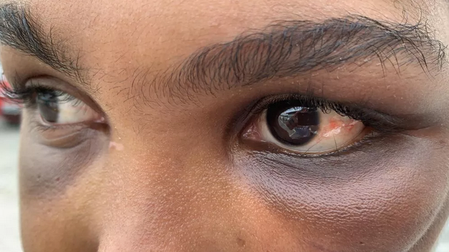 Vítima mostra marcas das agressões sofridas (Foto: Victor Silveira | TV Bahia) 