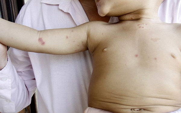 csm_bolha_f9e1bd6680