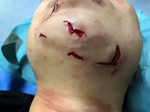 Mergulhadora teve rosto rasgado após mordida (Foto: AsiaWire)