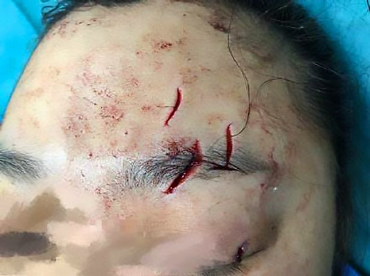 A professora de mergulho teve de passar por 4 horas de cirurgia após ataque (Foto: AsiaWire)