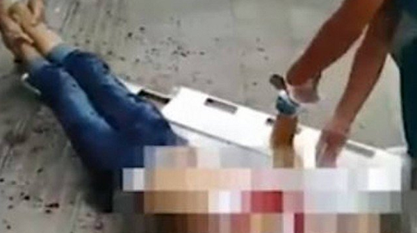 Vítima de ataque a tesouradas na China (Foto: Reprodução | JSTV)