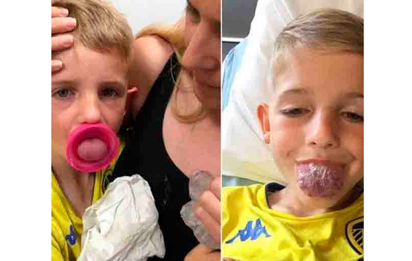 Riley corria risco de morte, pois sua língua não parava de inchar (Foto: Reprodução | Facebook)